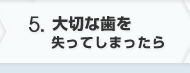 大切な歯を失ってしまったら